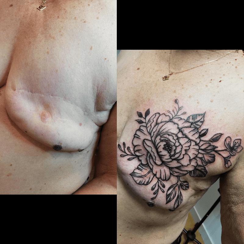 tatouage recouvrement cicatrice accueil fleur noir so-tattoo les essarts 85
