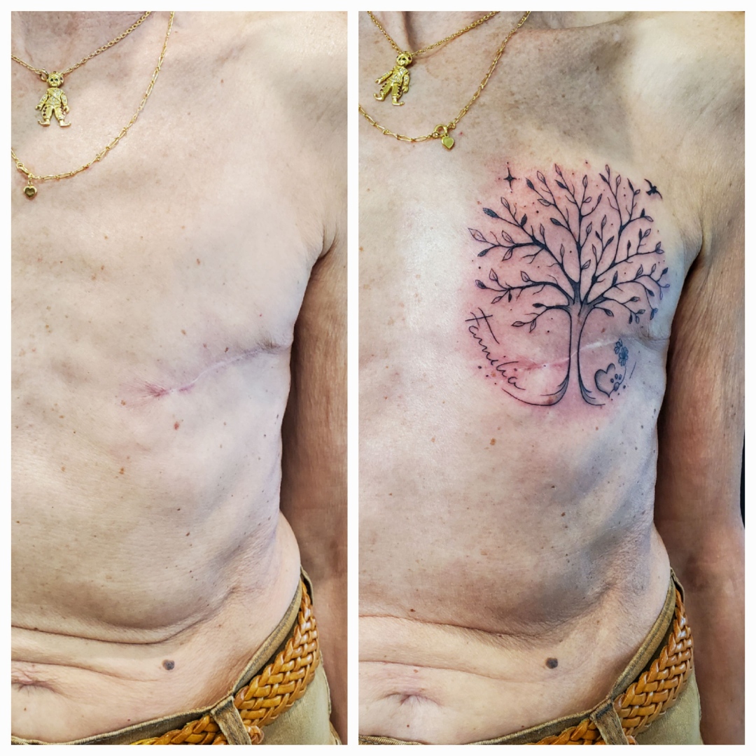 tatouage recouvrement cicatrice accueil fleur noir so-tattoo les essarts 85